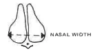 Manual Illustration